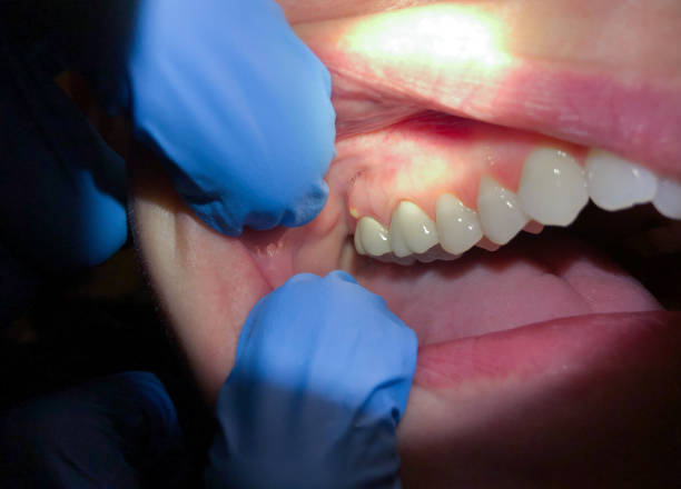 Best Emergency Broken Tooth Repair in Black Creek, WI