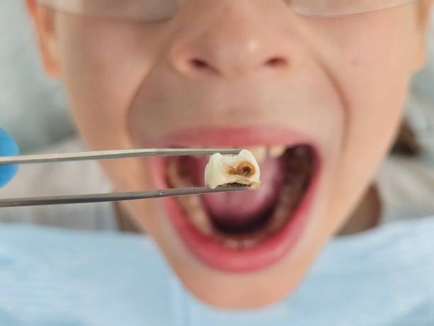 Best Walk-In Emergency Dentist in Black Creek, WI