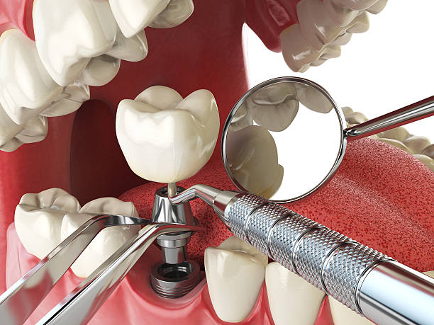 Best Emergency Treatment for Toothache in Black Creek, WI