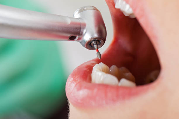 Best Pediatric Emergency Dentist in Black Creek, WI